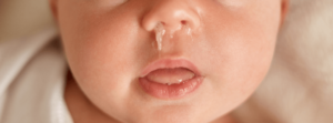 baby's nose with boogers